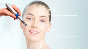 Micro needling Therapy