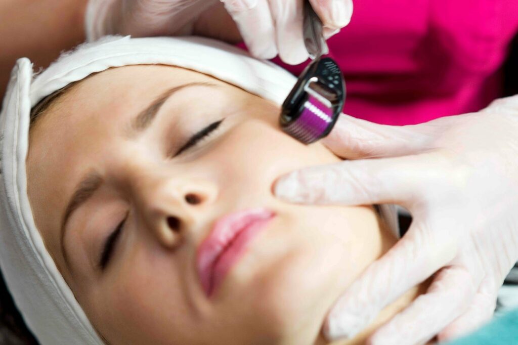 Microneedle Therapy